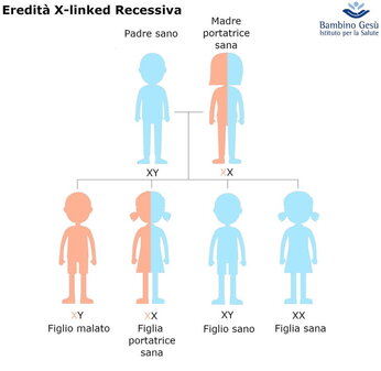Sindrome di Alport