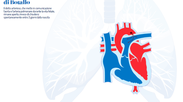 Sindrome di Down e cardiopatie congenite