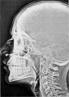 Chirurgia cranio-maxillo-facciale