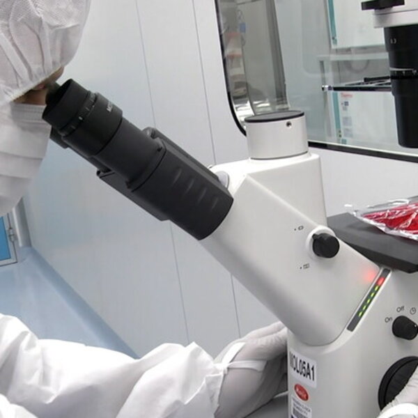 Leucemia trattati primi tre bambini terapia CAR-T grazie innovativa produzione automatizzata