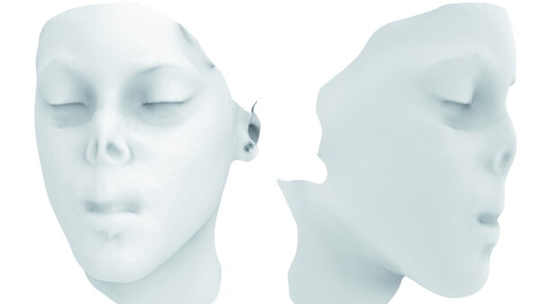 Ricostruito naso bambino aggredito animale