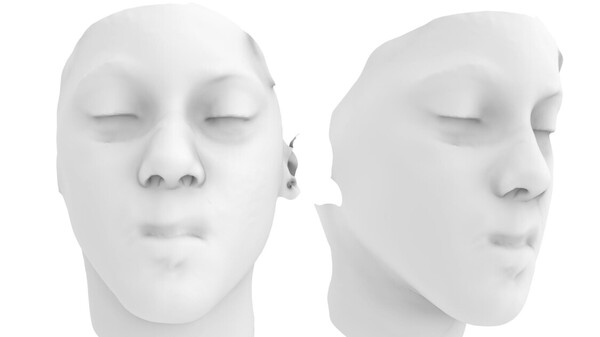 Ricostruito naso bambino aggredito animale