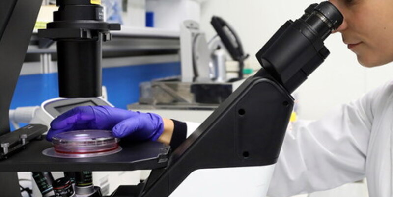 Uno studio dei ricercatori dell'ospedale conferma il legame tra mononucleosi e sclerosi multipla nei bambini