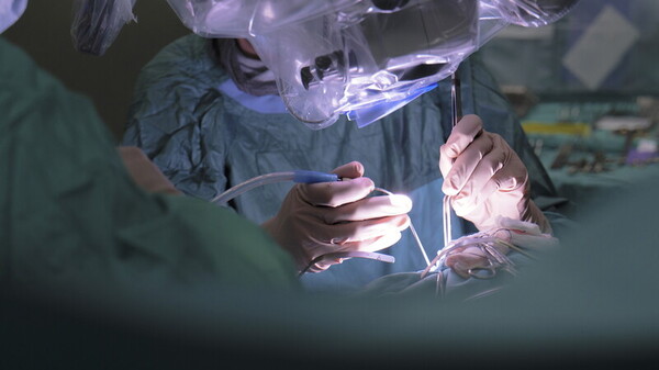 Trapianto cornea altissimo rischio intervento riuscito grazie task force 6 specialità
